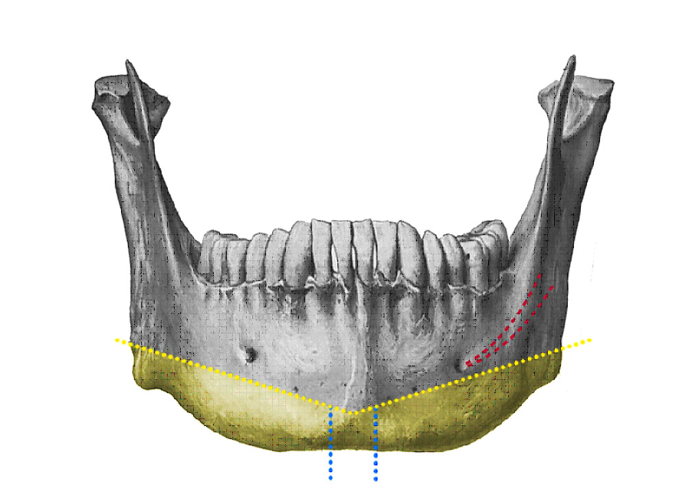 facial_conturing_10