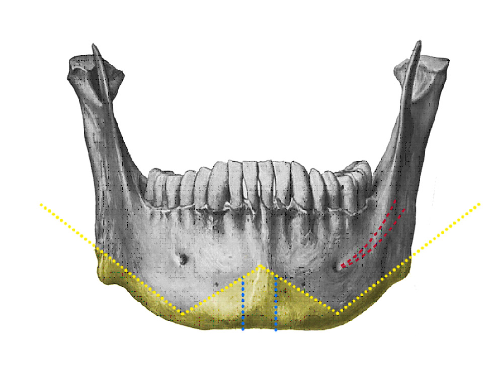 facial_conturing_12